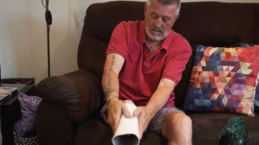 Terry An Amputee Putting On His Prosthetic Leg.